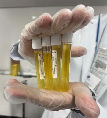 Medicina Regenerativa​